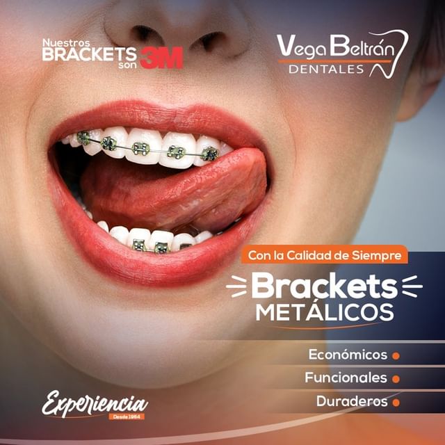 Brackets Metalicos (Ortodoncia)