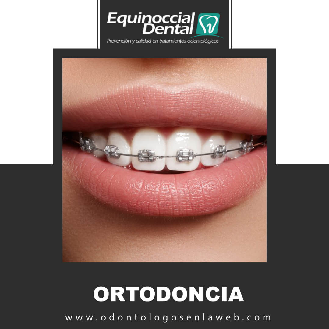 Ortodoncia 