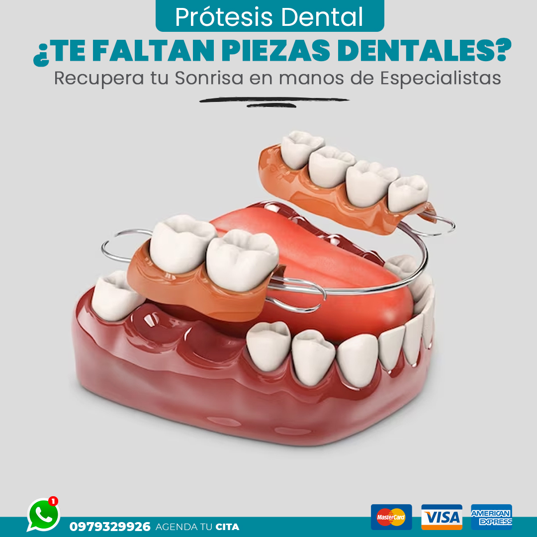 Prótesis Dental