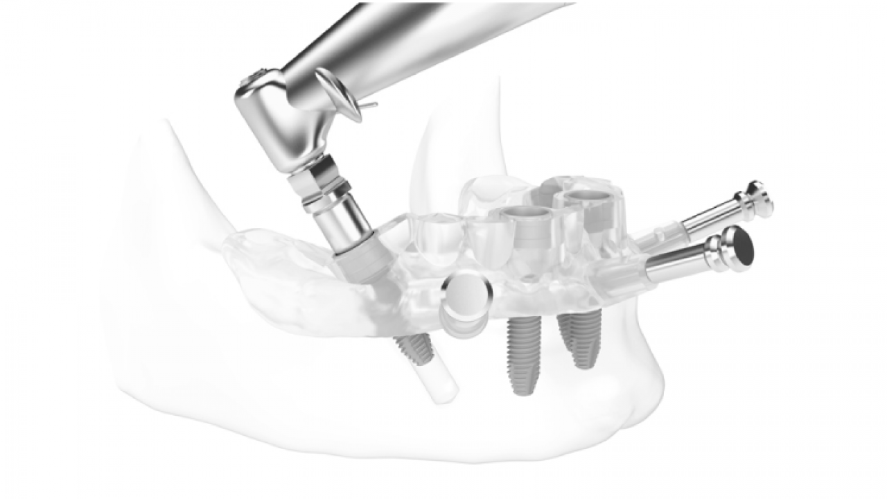 colocacion-implantes-dentales