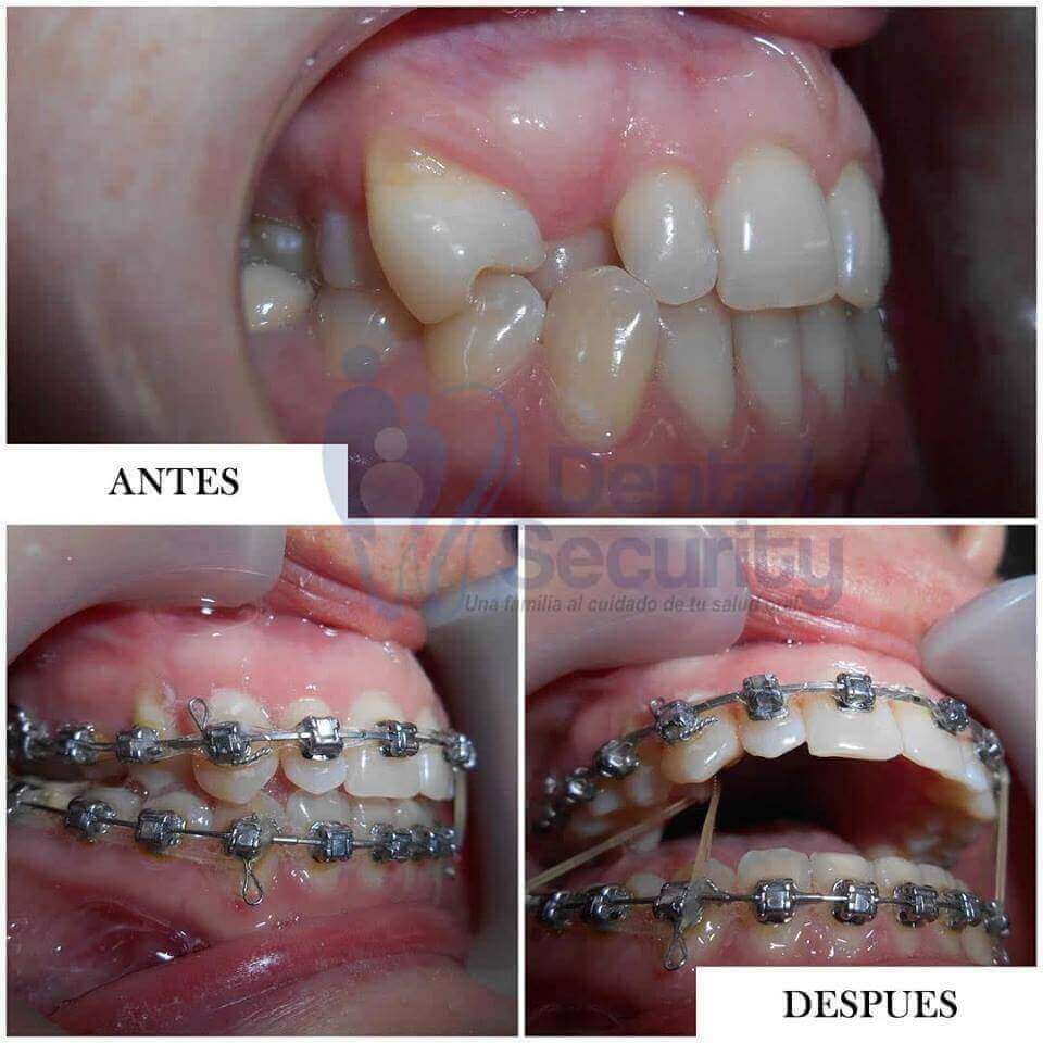 Consulta tu caso con nuestro especialista obten el resultado esperado👍👨‍⚕