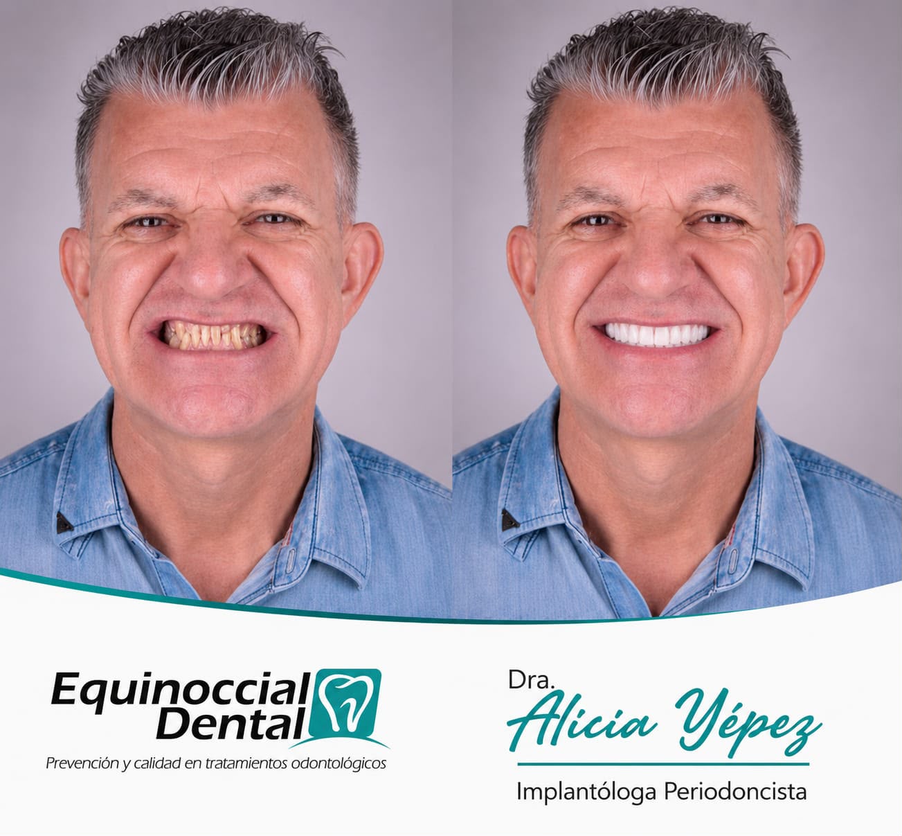 El poder de una sonrisa renovada