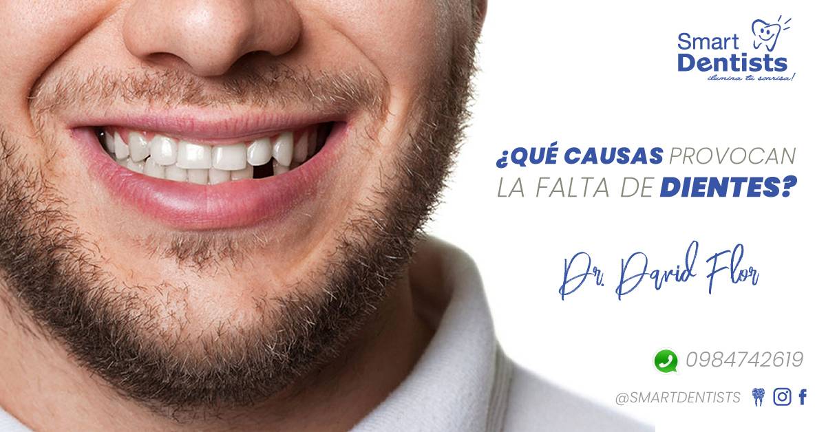 ¿QUÉ CAUSAS PROVOCAN LA FALTA DE DIENTES?