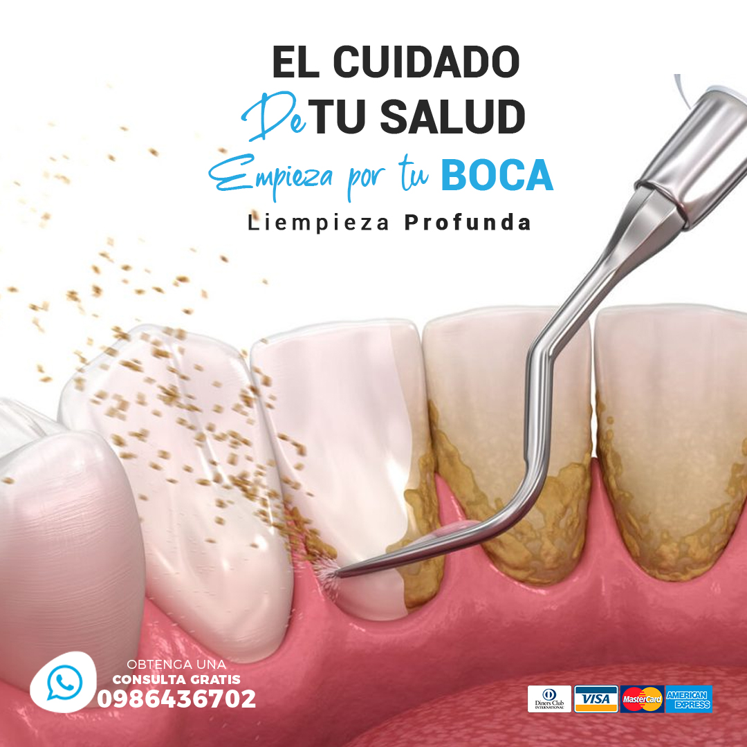 Limpieza Dental