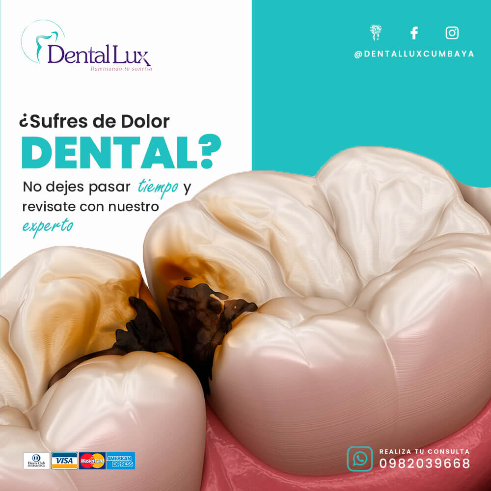 Restauración Dental (Caries)