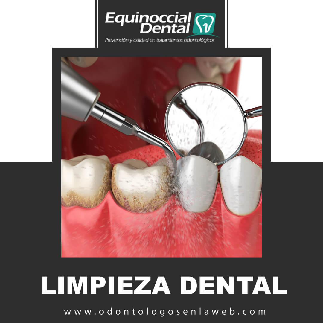 Limpieza Dental