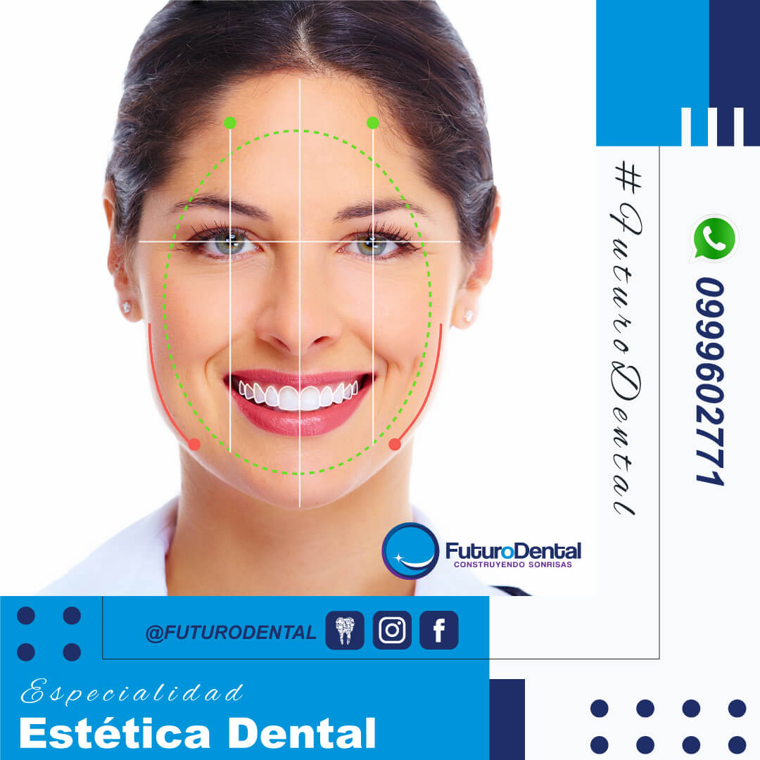 Diseño de Sonrisa