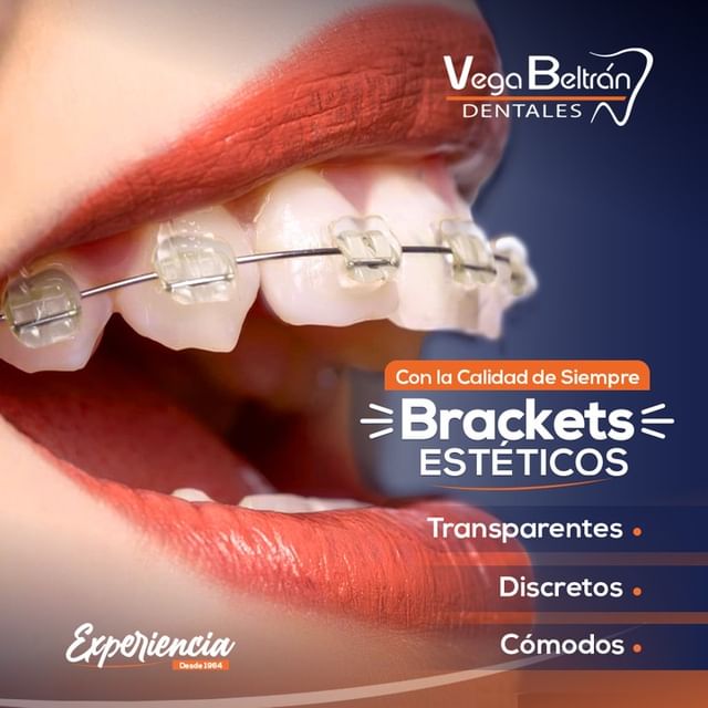 Brackets Estéticos 