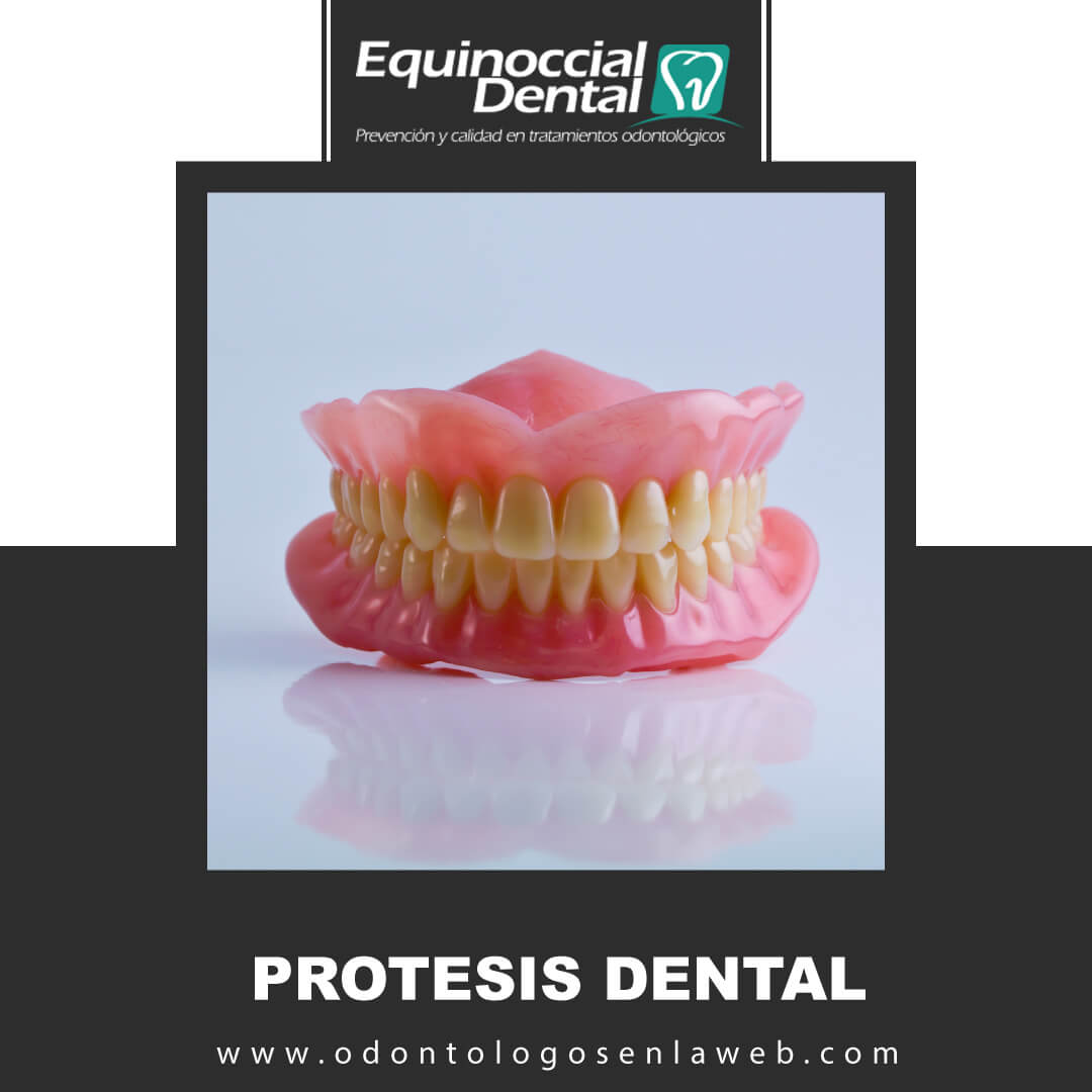 Protesis Dental