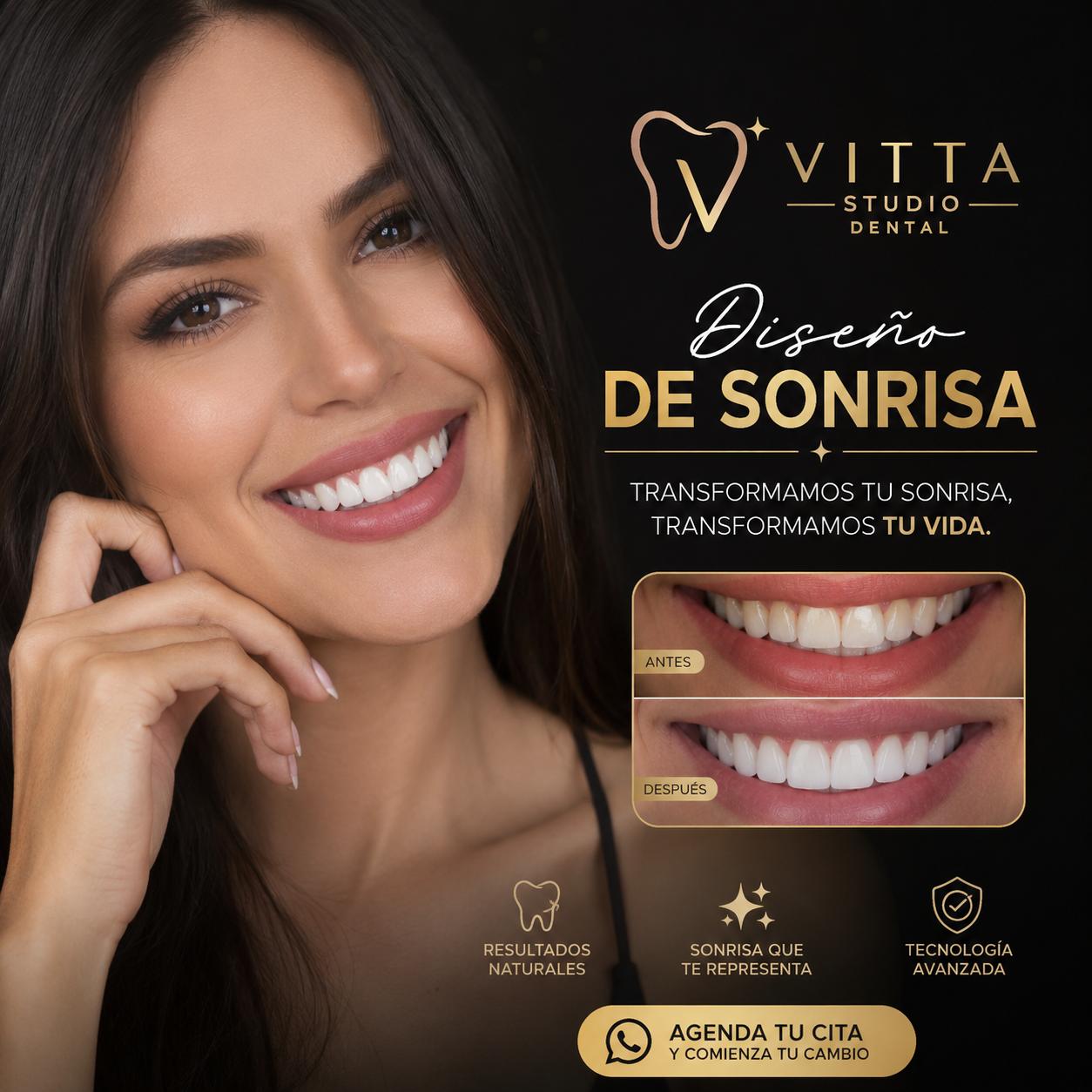 Diseño de Sonrisa