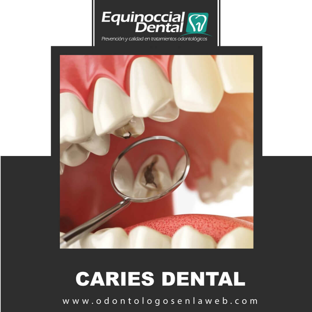 Caries Dental