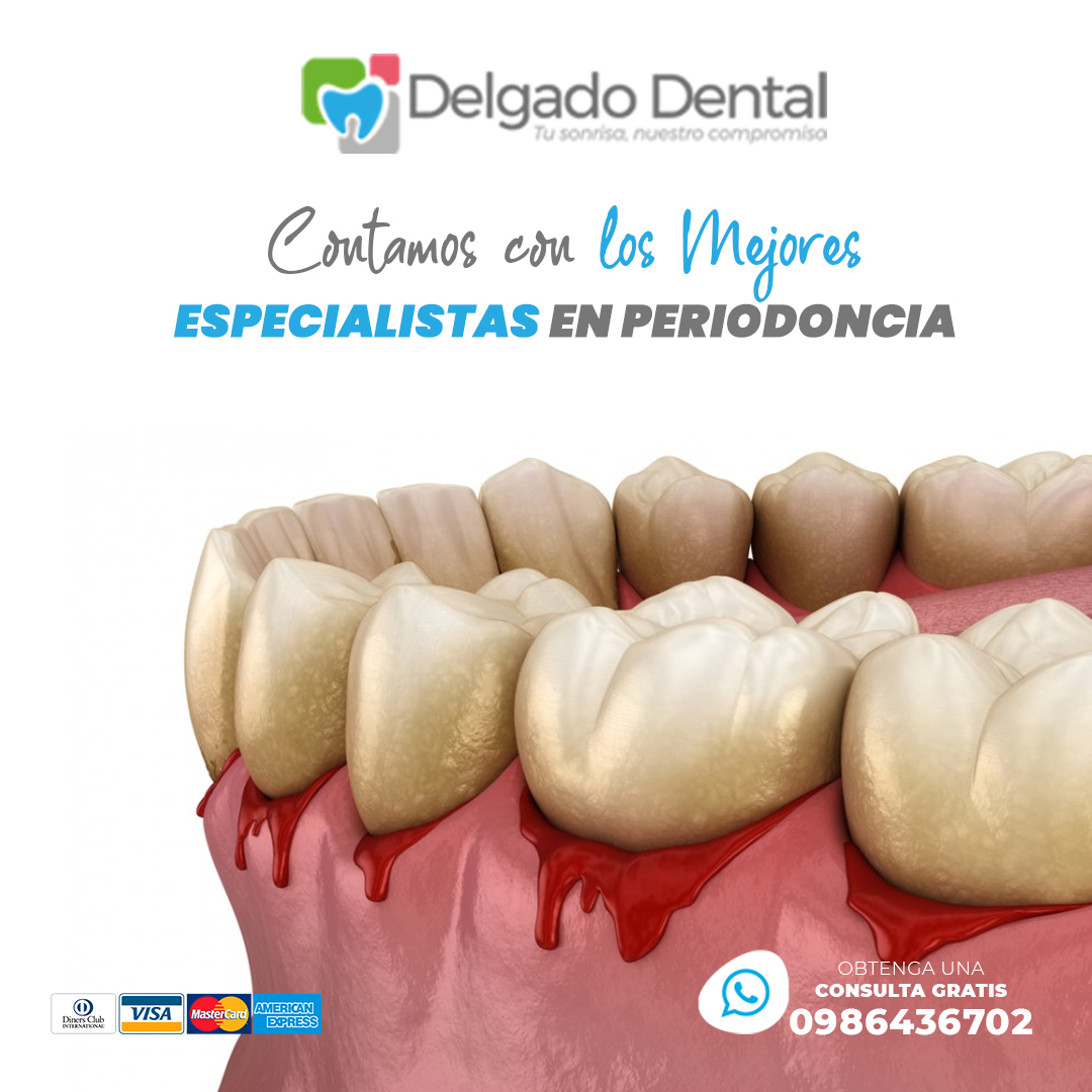 Periodoncia