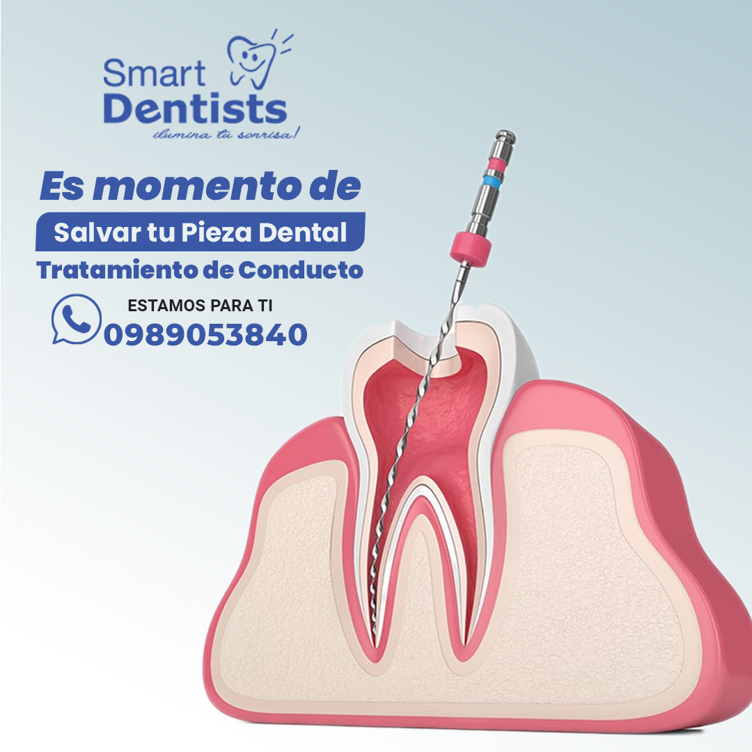 Endodoncia