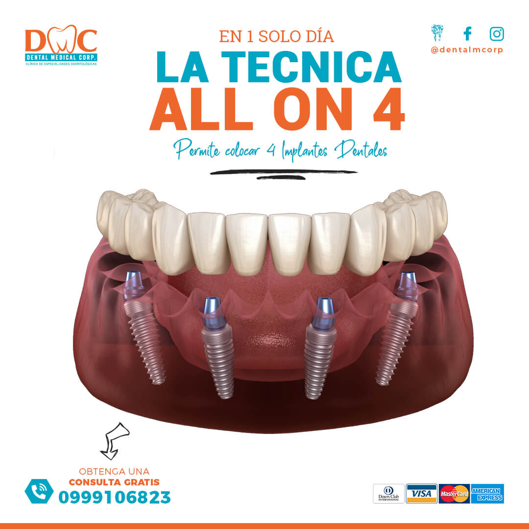 Implantologia dental