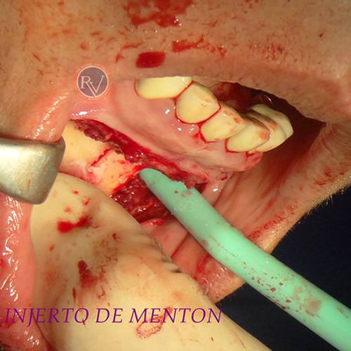 Cirugia Oral y Maxilofacial