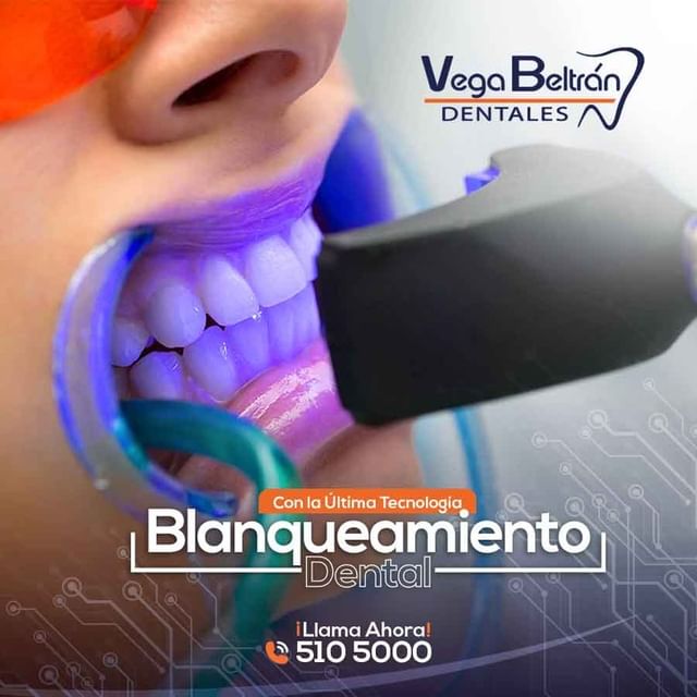 Blanqueamiento Dental (Dientes blancos en un día)