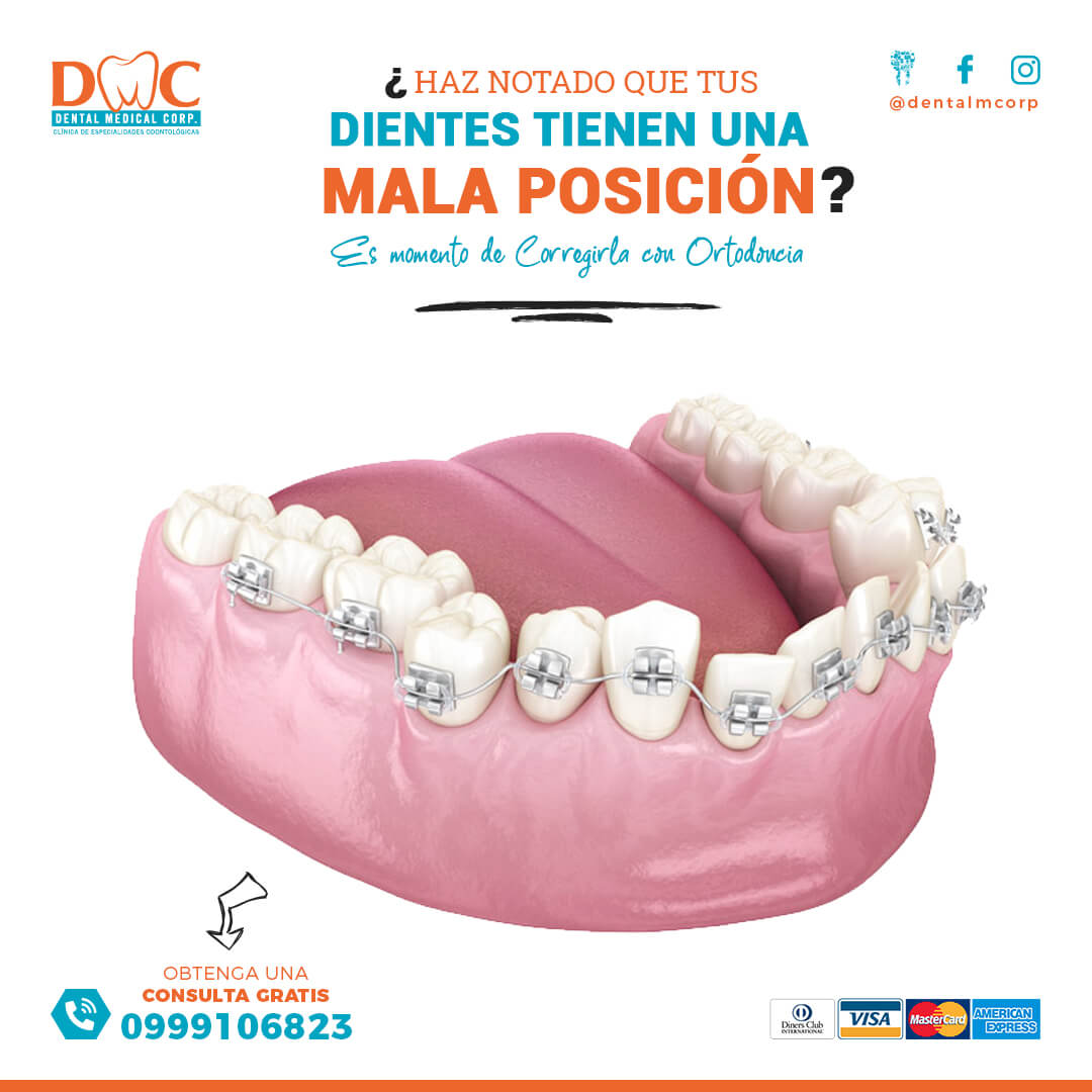 Ortodoncia (Brackets)