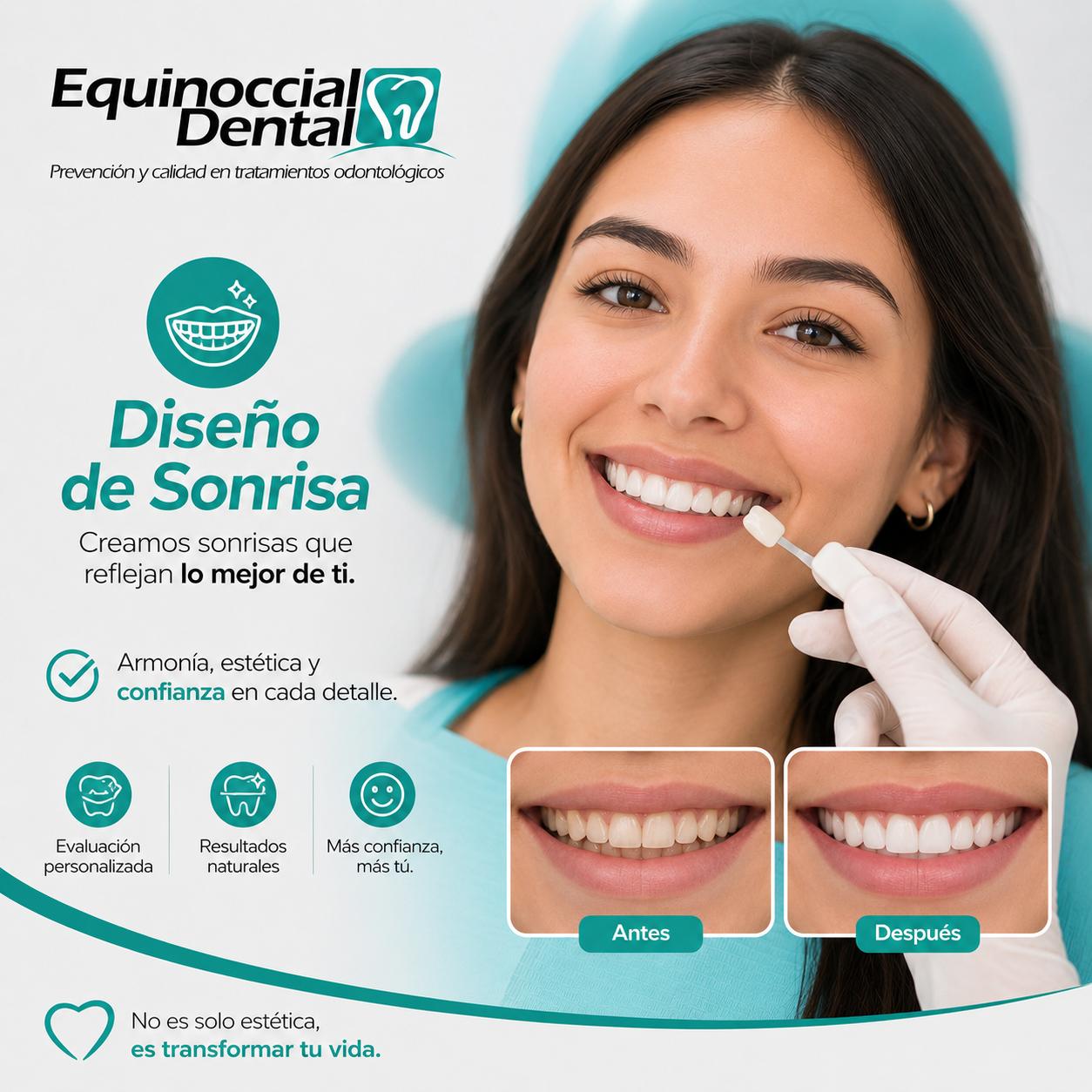 Diseño de Sonrisa 