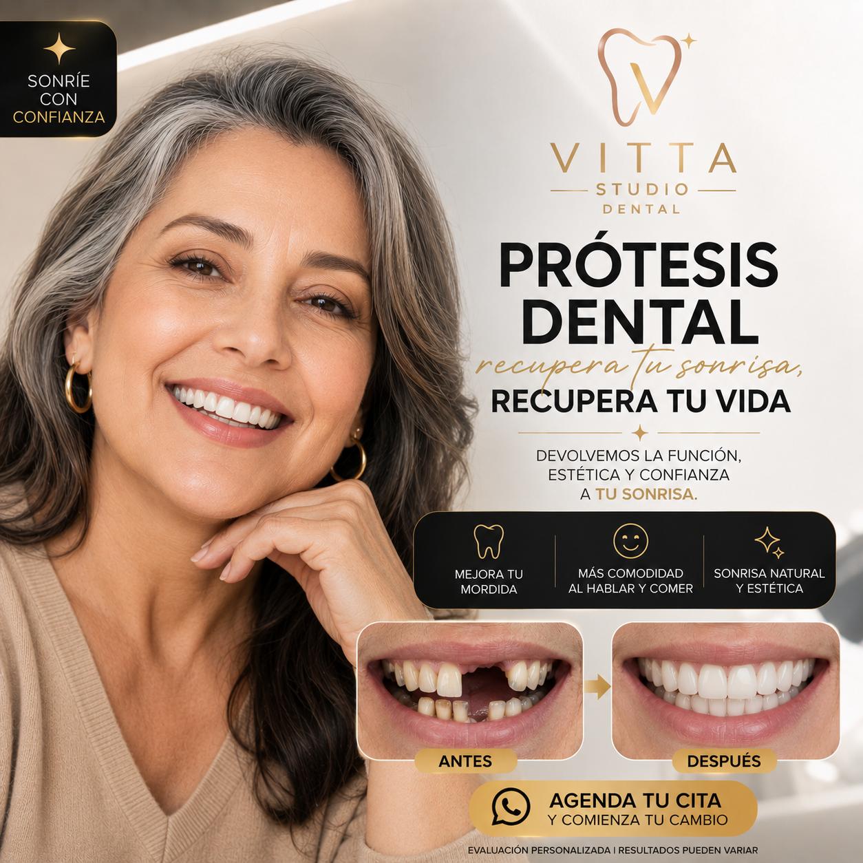 Prótesis Dental
