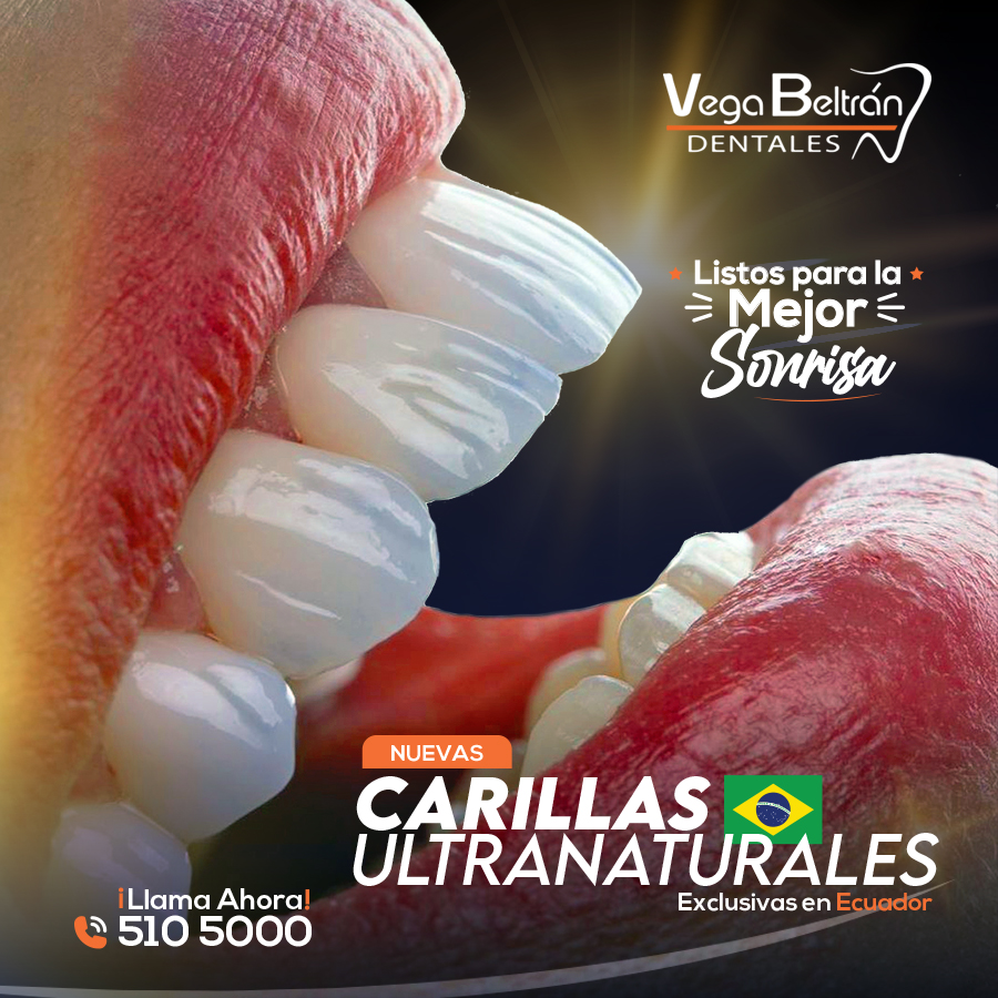 Carillas Dentales Ultra Naturales