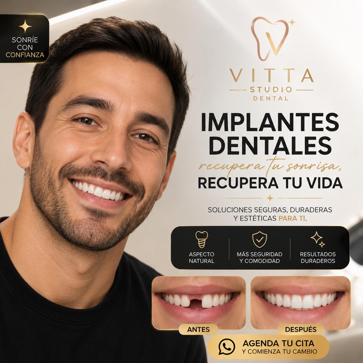 Implantes Dentales