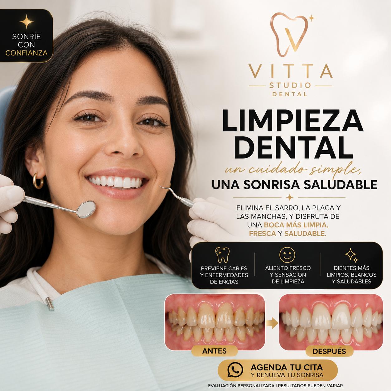 Limpieza Dental