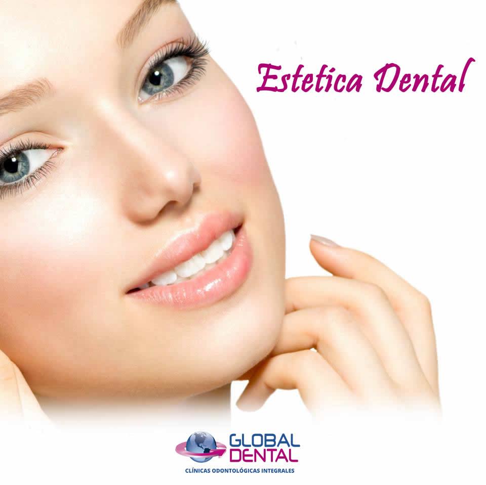 Estética Dental