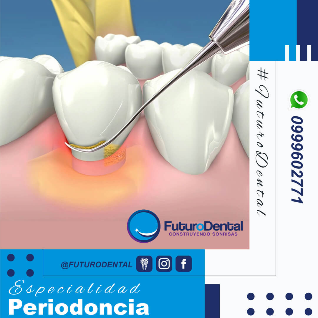  Periodoncia