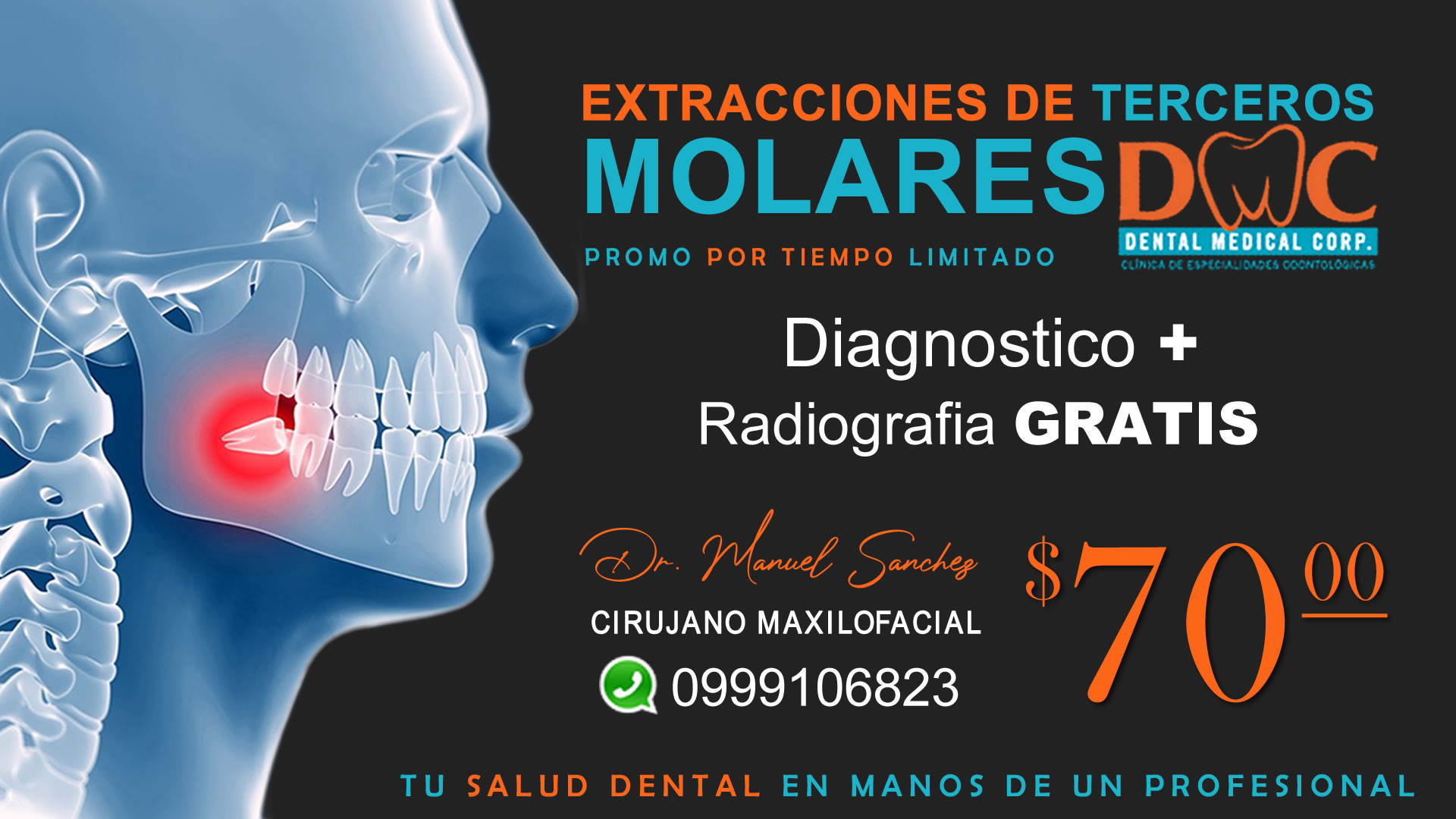 No pierdas esta oportunidad ✅  Promoción Extracción de Terceros Molares (Incluidas o Erupcionadas) por $70,00 