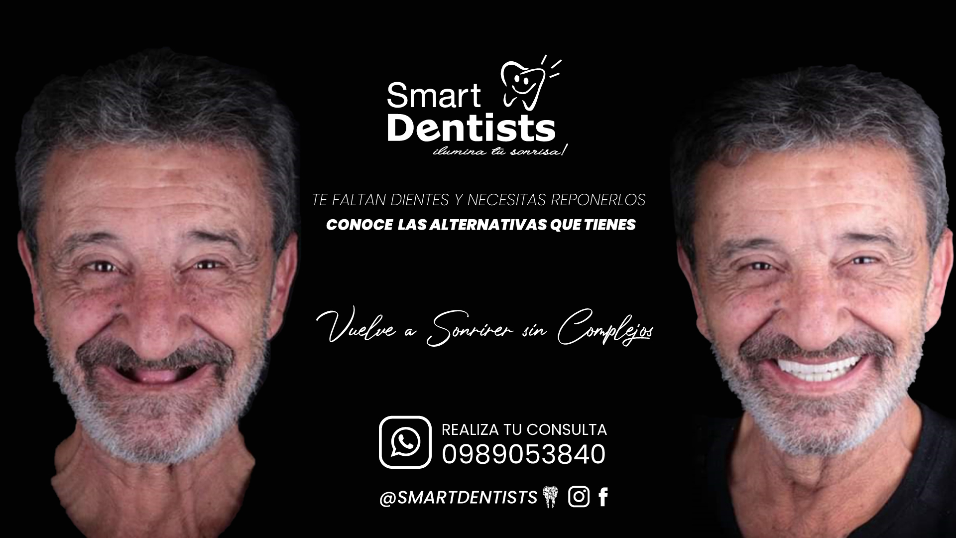 TE FALTAN DIENTES Y NECESITAS REPONERLOS?