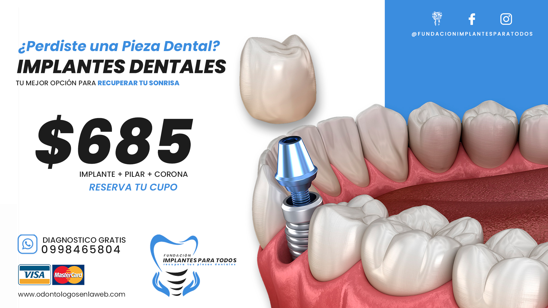 👉 Gran PROMO de IMPLANTES DENTALES de Titanio ✅ 