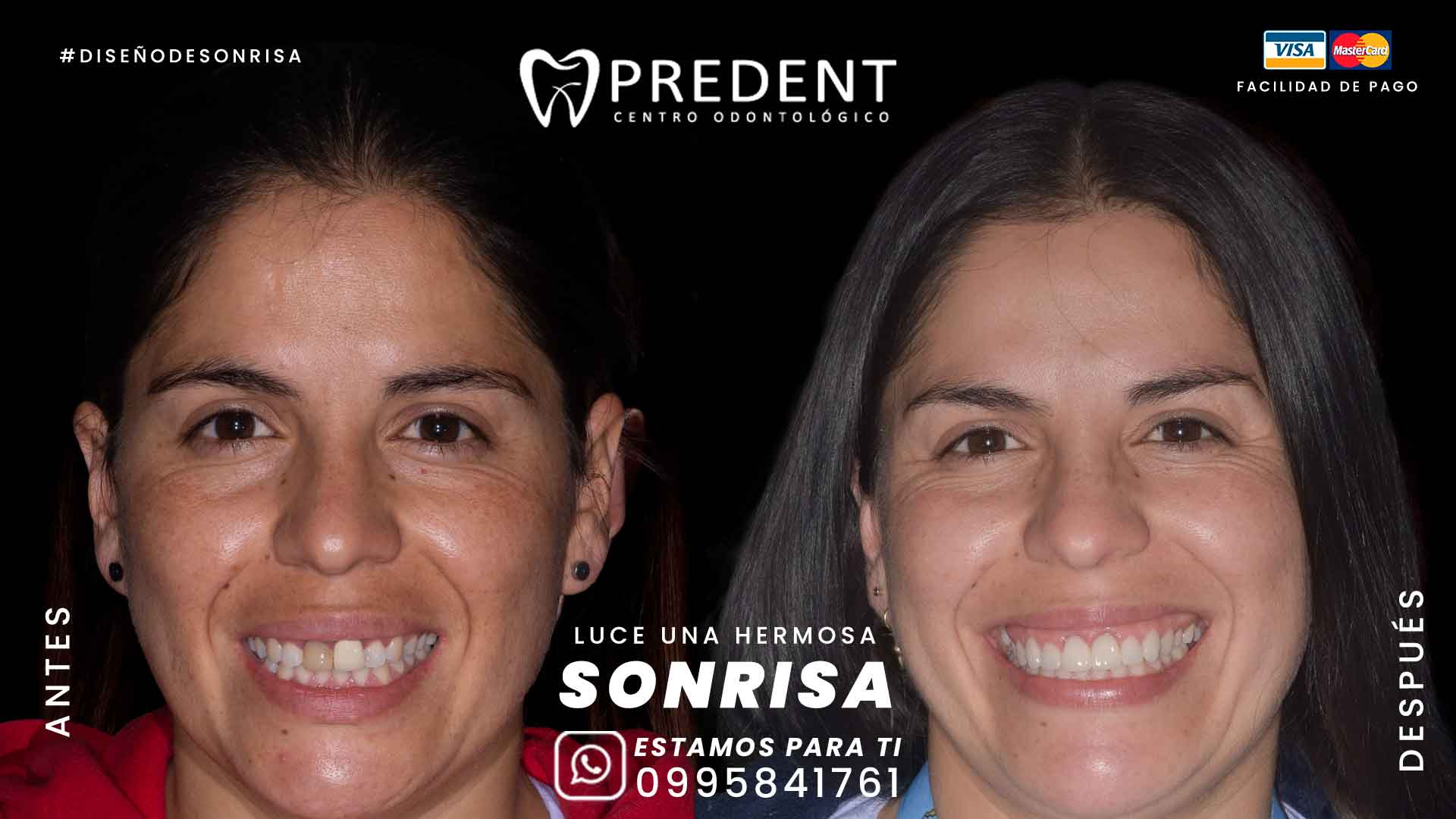 Tu mejor inversión es en TI! ✨ Luce una Hermosa Sonrisa